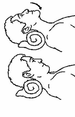 neck1