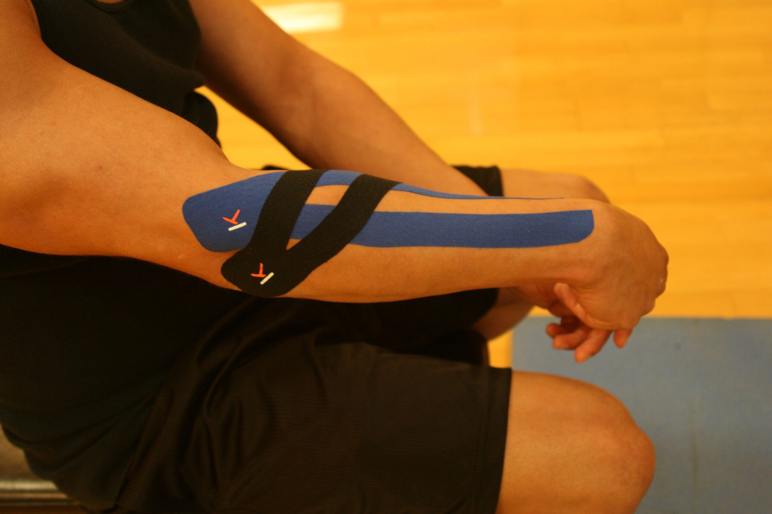 Kinesio taping: η μέθοδος και εφαρμογή της στις αθλητικές κακώσεις